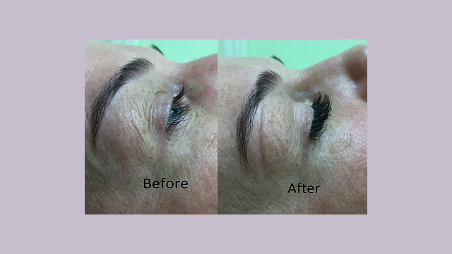 Eyelash Extensions in Lone Tree, CO